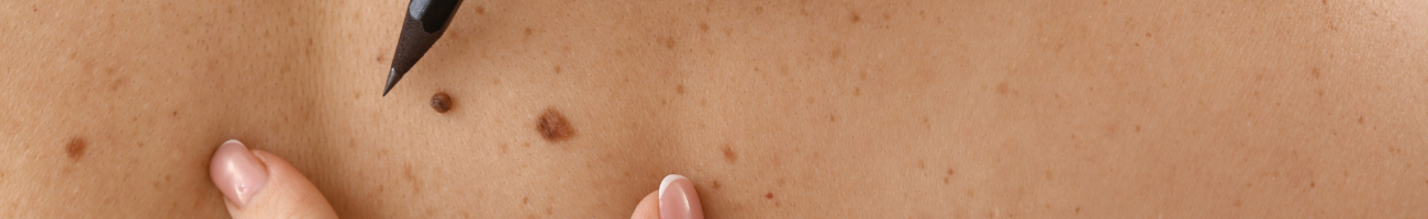 Discoveries in Dermatology Research Reviews and Reports