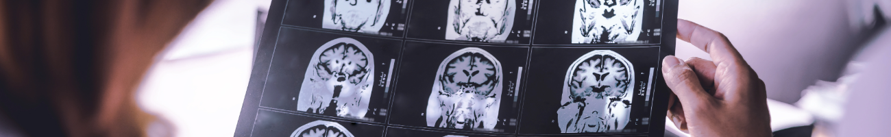 Discoveries in Clinical Neurosciences and Psychiatry Research and Reports